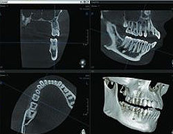 DVT Fortbildung für Zahnärzte und Mediziner - Fachkunde Strahlenschutz